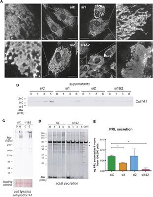 CREB3L1 and CREB3L2 control Golgi remodelling during decidualization of endometrial stromal cells